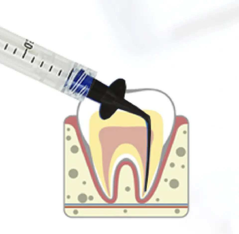 PUNTAS PARA IRRIGACIÓN PLÁSTICAS 0.35 MM WISSEN  2