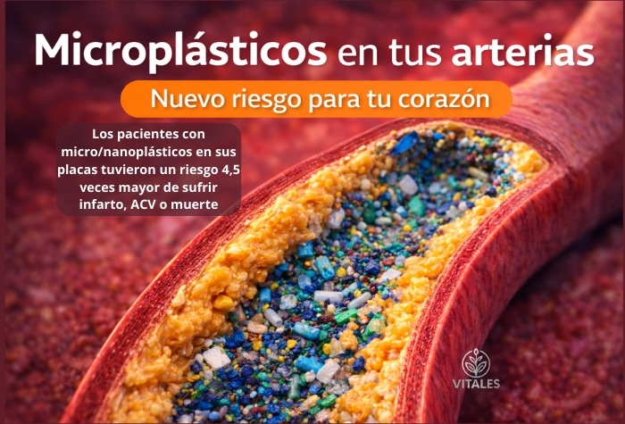 Microplásticos, nanoplásticos y salud cardiovascular: lo que revela un estudio del New England Journal of Medicine