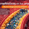 Microplásticos, nanoplásticos y salud cardiovascular: lo que revela un estudio del New England Journal of Medicine