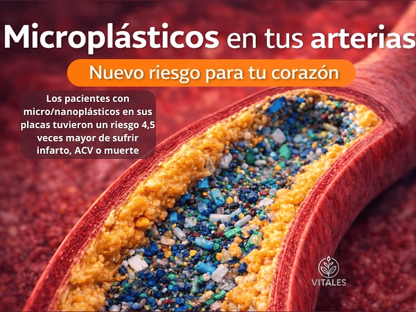 Microplásticos, nanoplásticos y salud cardiovascular: lo que revela un estudio del New England Journal of Medicine