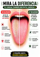 Kit Premium Limpiador de Lengua en Acero Inoxidable con Estuche Metálico | Raspador en “U” + Raspador de Precisión Tipo Cuchara | Higiene Oral Profunda y Aliento Fresco - Miniatura 2