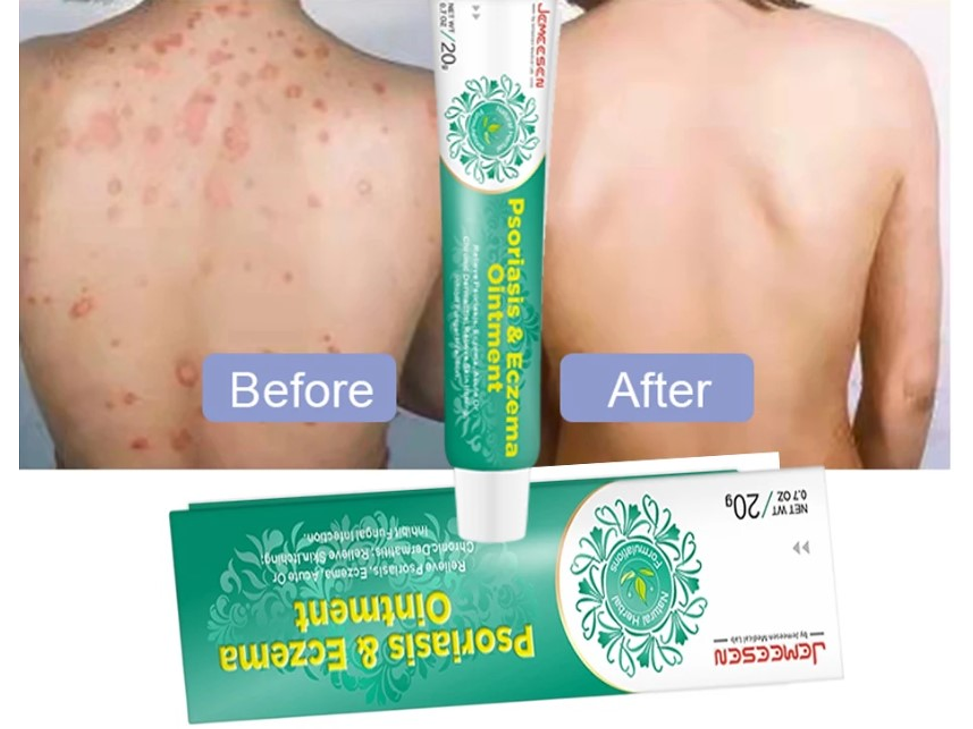 Crema Jemeesen a Base de Extractos Naturales para el Cuidado de la Piel con Tendencia a Psoriasis y Eczema – 20 g 2