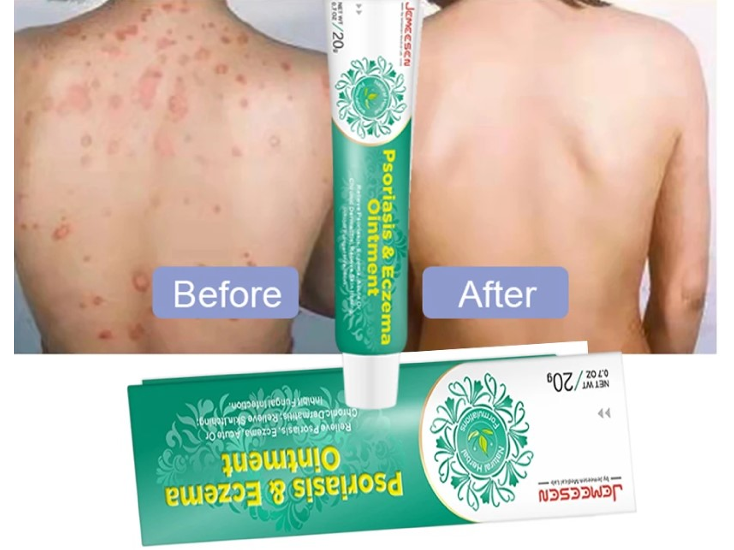 Crema Jemeesen a Base de Extractos Naturales para el Cuidado de la Piel con Tendencia a Psoriasis y Eczema – 20 g 2