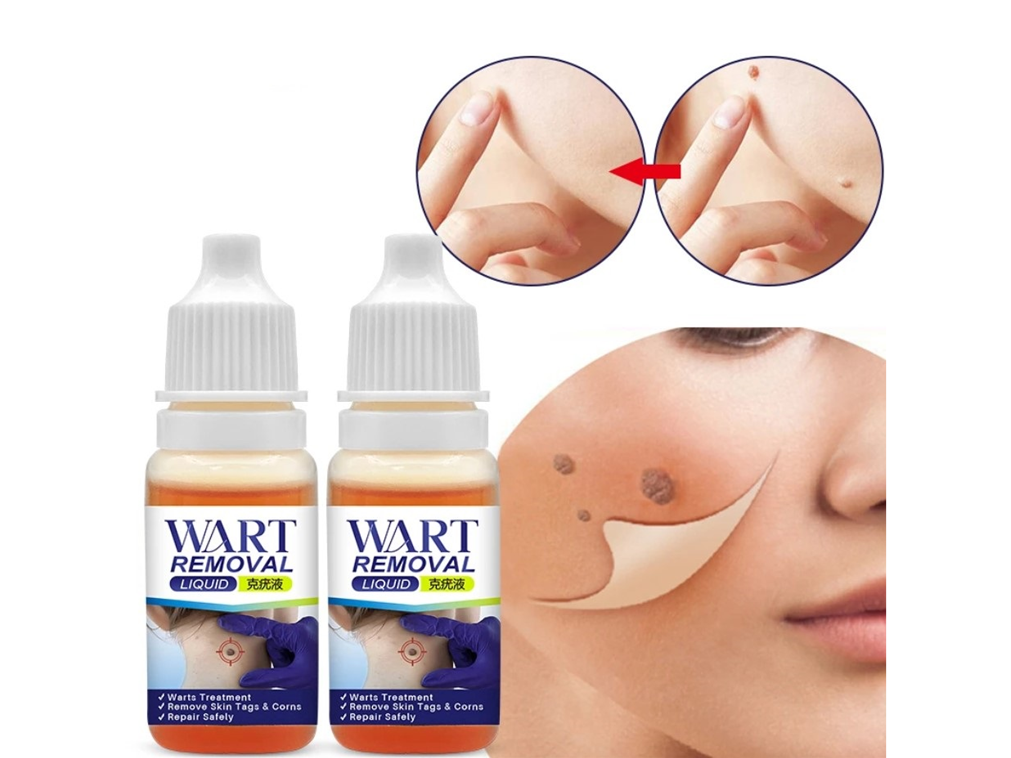 Líquido KanyeHB para Verrugas con Extractos Naturales – Uso Tópico (10 ml) 3