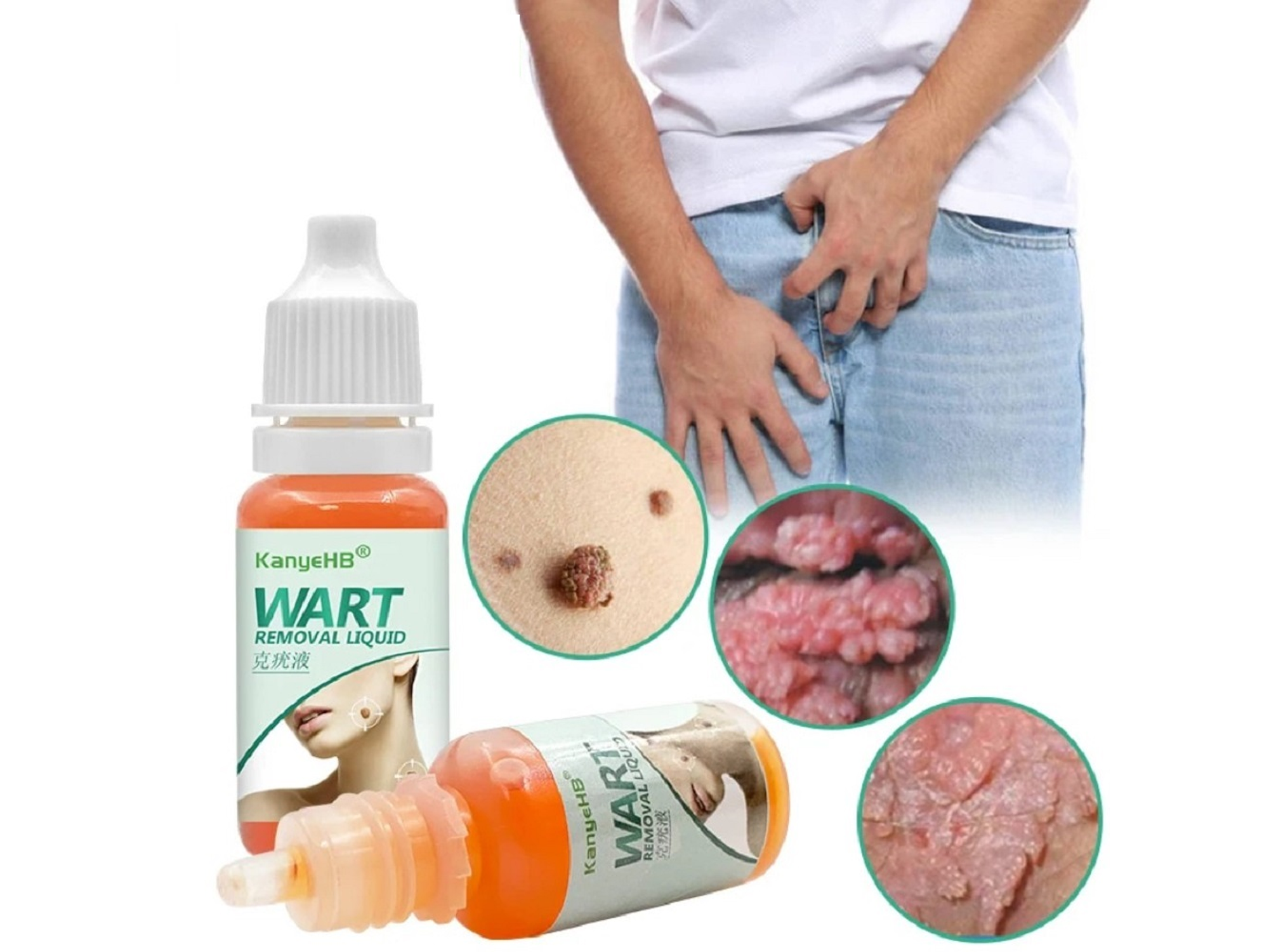 Líquido KanyeHB para Verrugas con Extractos Naturales – Uso Tópico (10 ml) 4
