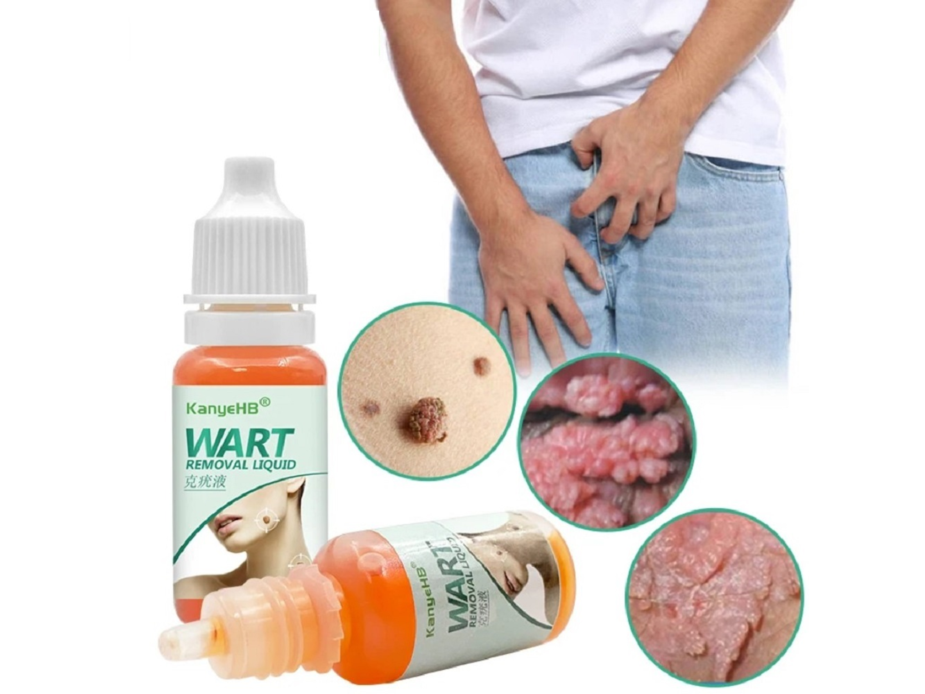 Líquido KanyeHB para Verrugas con Extractos Naturales – Uso Tópico (10 ml) 4
