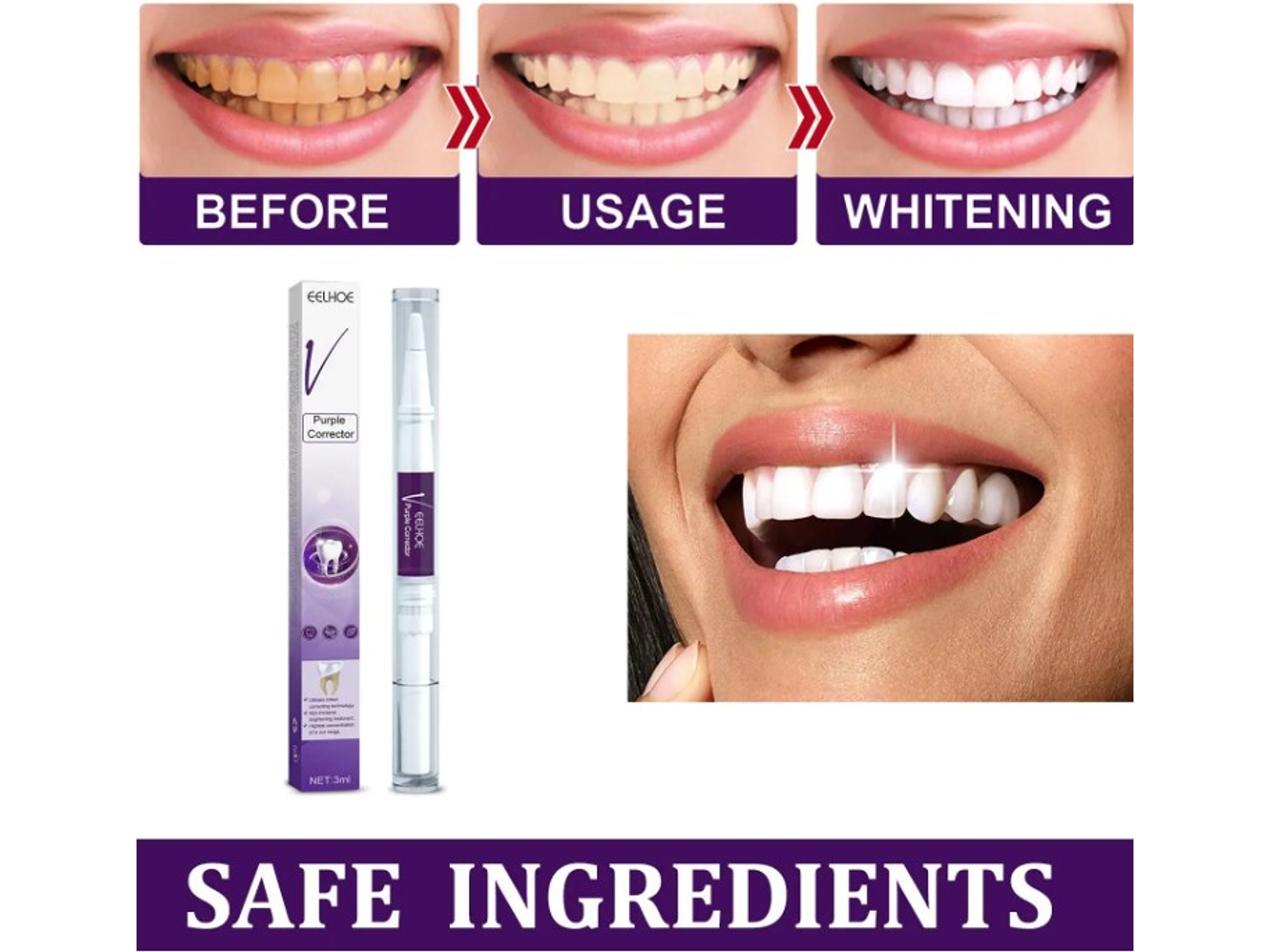 Lápiz Gel Blanqueador de Dientes – Uso Dental Cosmético 2