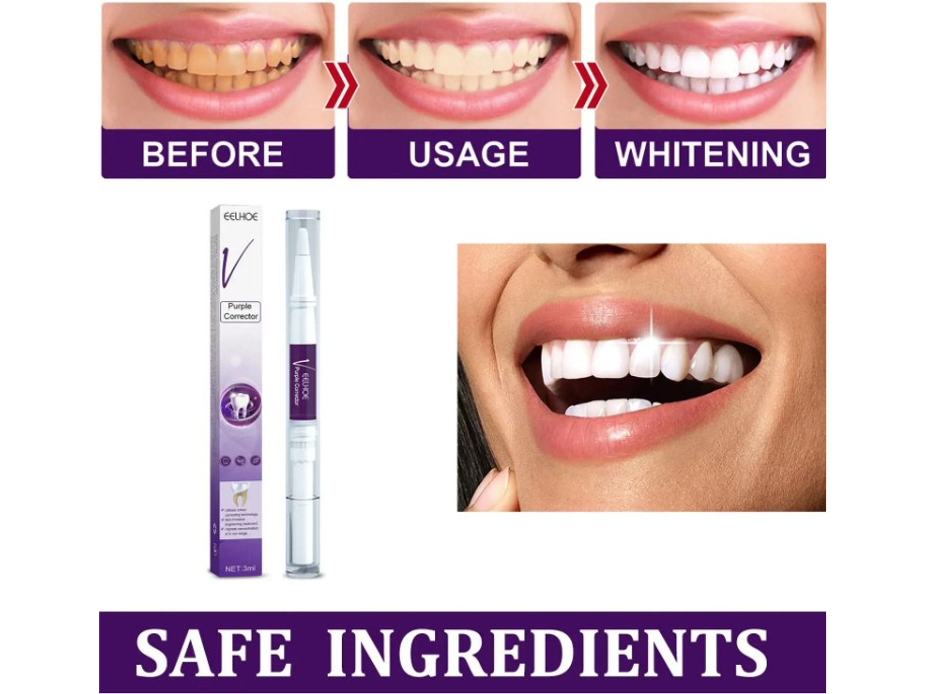 Lápiz Gel Blanqueador de Dientes – Uso Dental Cosmético 2