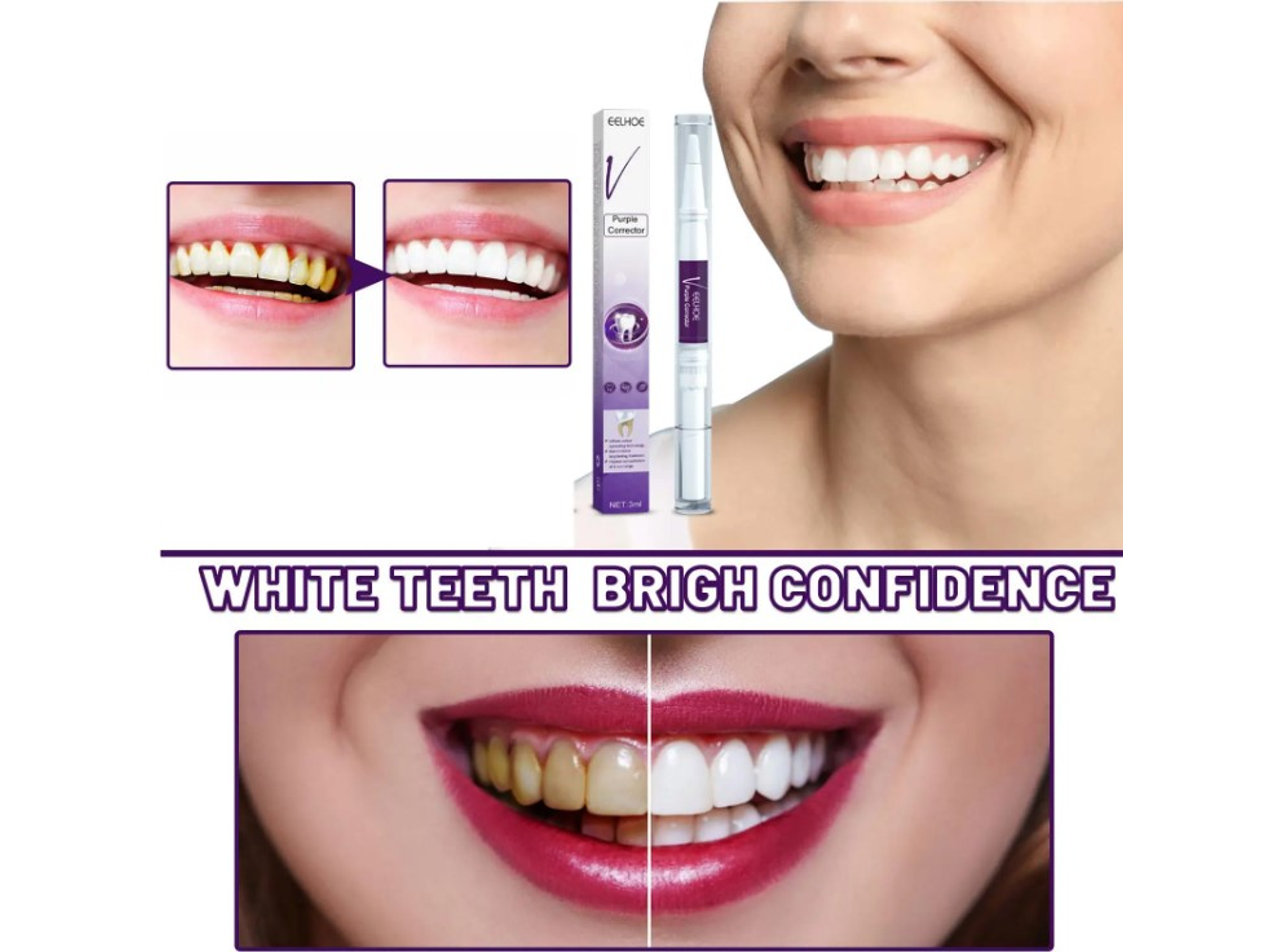 Lápiz Gel Blanqueador de Dientes – Uso Dental Cosmético 4