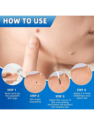 Serum HOLJKEA para Skin Tags con Extractos Naturales – Uso Tópico (20 ml)