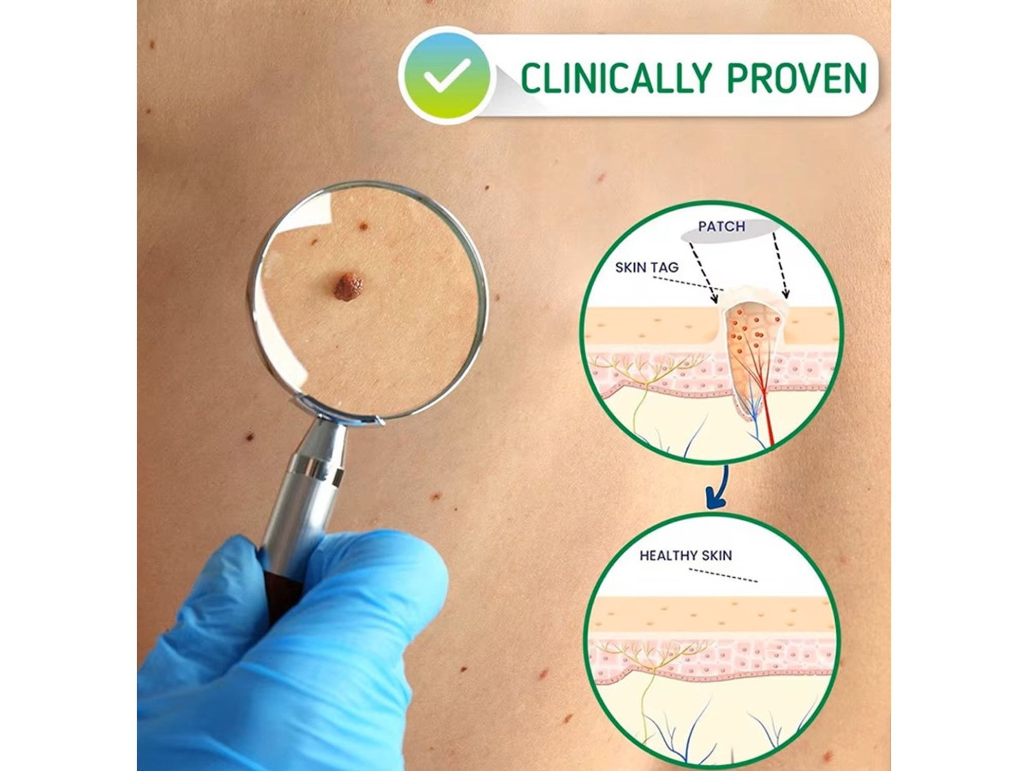 Serum HOLJKEA para Skin Tags con Extractos Naturales – Uso Tópico (20 ml) 3