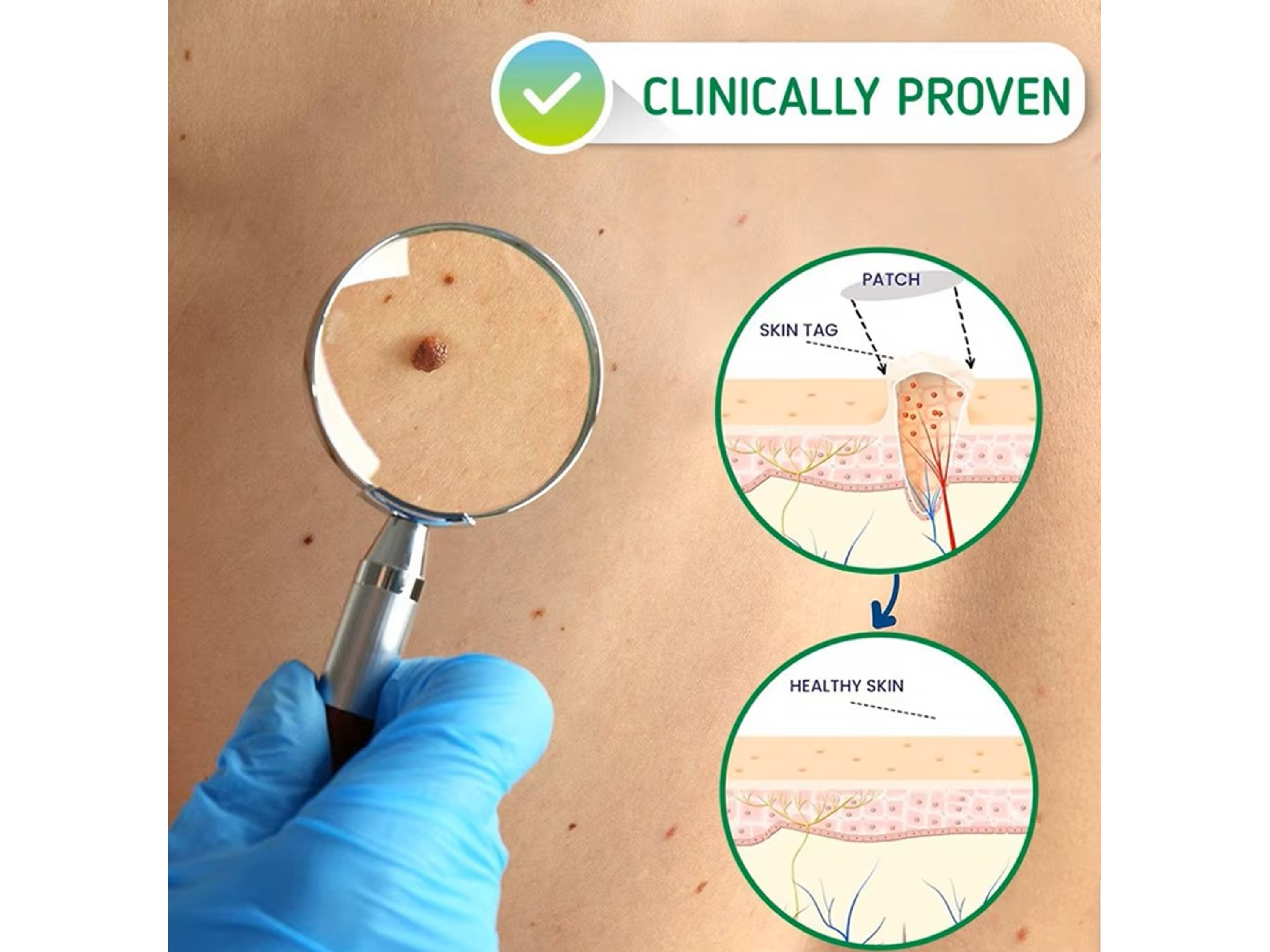 Serum HOLJKEA para Skin Tags con Extractos Naturales – Uso Tópico (20 ml) 3