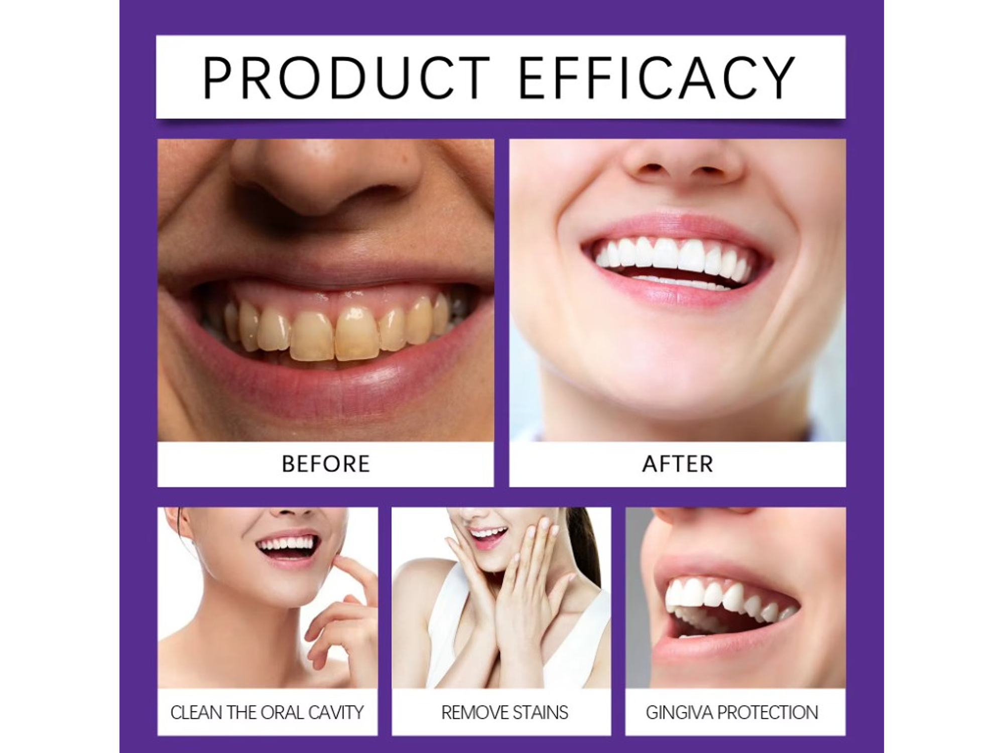 Polvo Blanqueador Morado – Cuidado Estético Dental 5