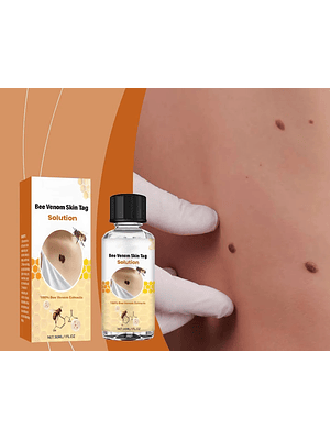 Solución South Moon para Skin Tags y Verrugas con Extractos Naturales – Uso Tópico (30 ml)
