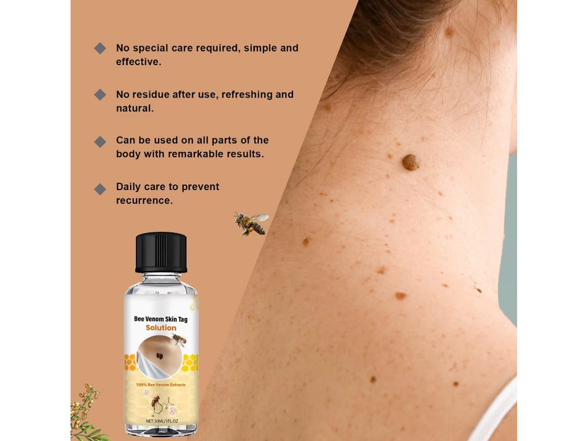 Solución South Moon para Skin Tags y Verrugas con Extractos Naturales – Uso Tópico (30 ml) 5