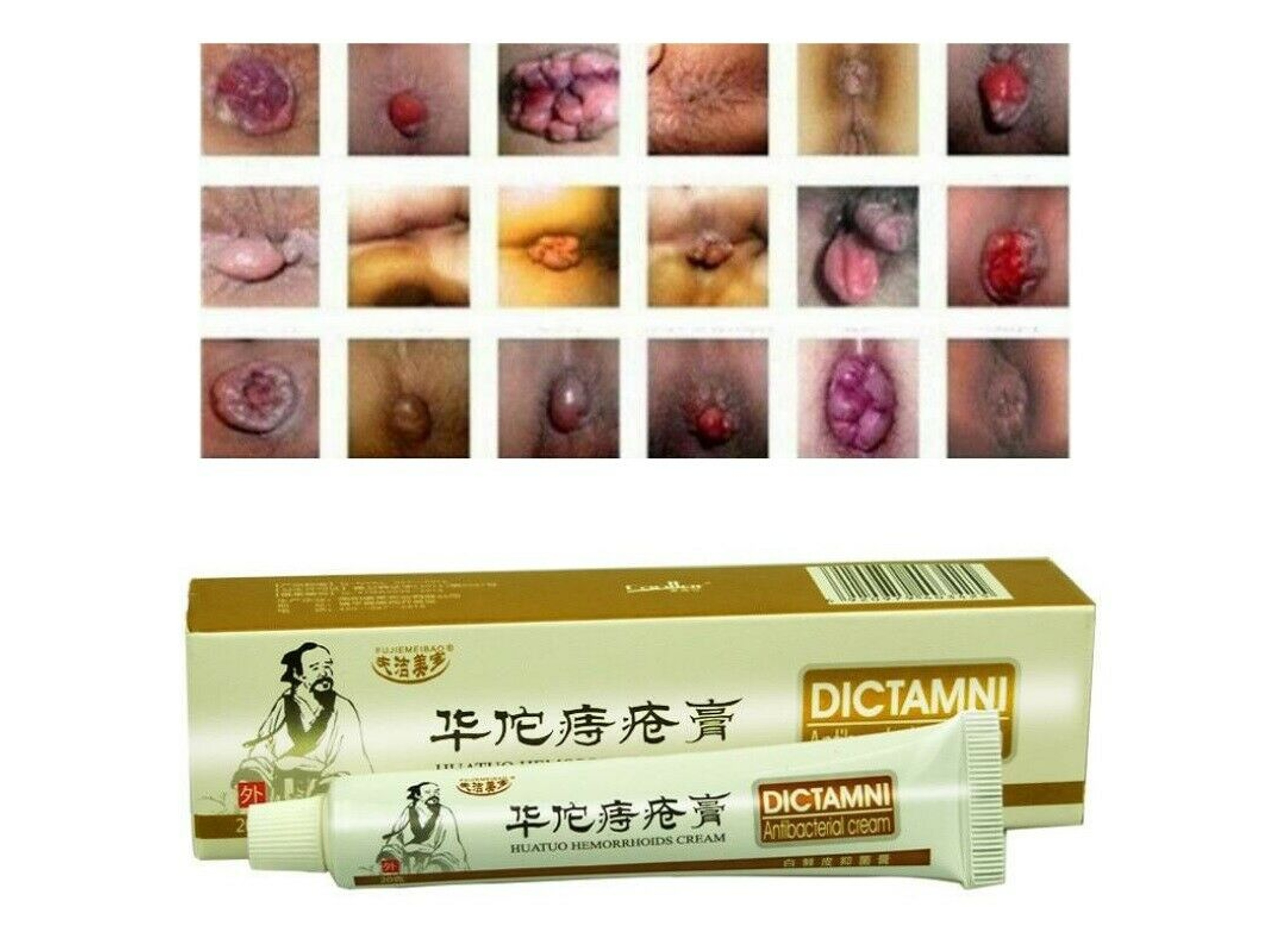 Crema Dictamni a Base de Extractos Naturales para el Cuidado de la Zona Anal con Molestias o Incomodidad Cutánea – 20 g 2