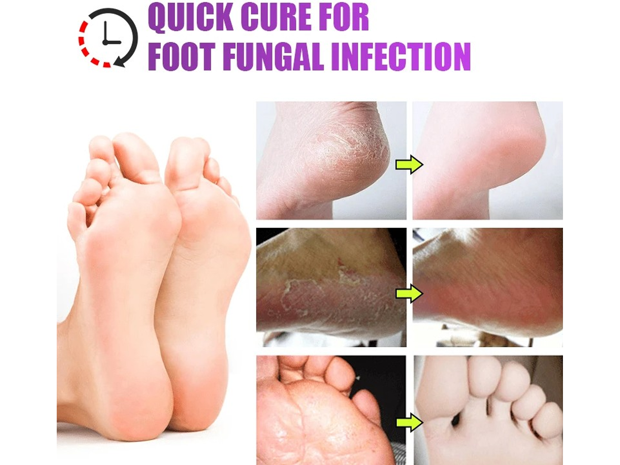 Crema contra el Mal Olor de Pies – Chao Mal Olor 20 g 3