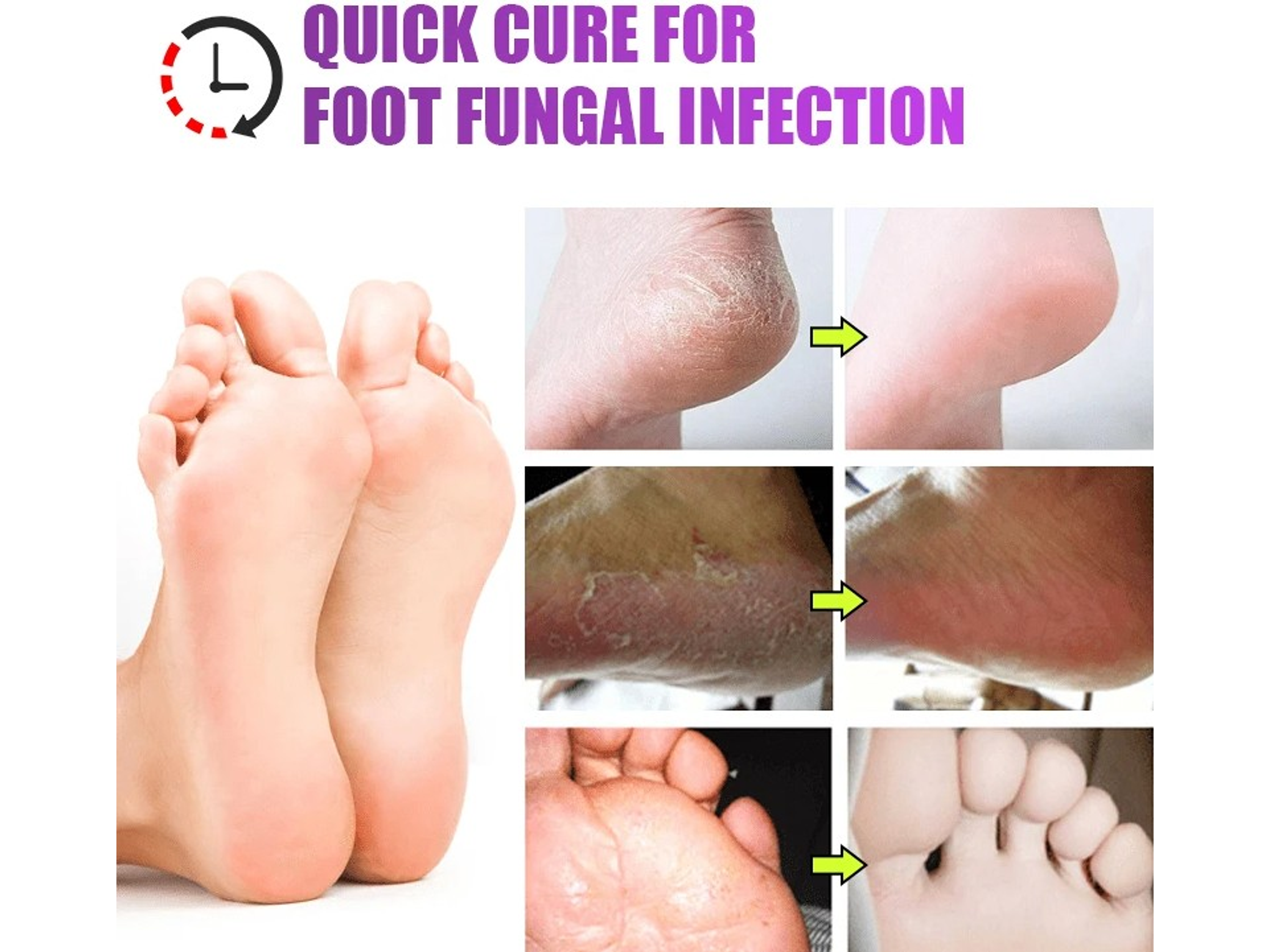 Crema contra el Mal Olor de Pies – Chao Mal Olor 20 g 3