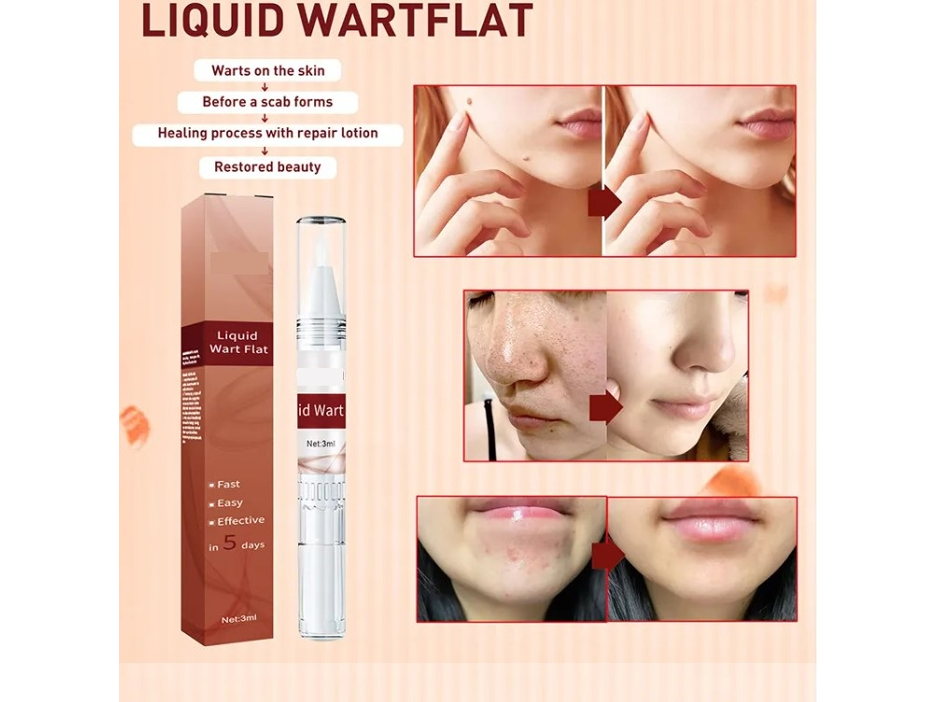 Líquido Jaysuing para Verrugas – Aplicación Localizada (3 ml) 3