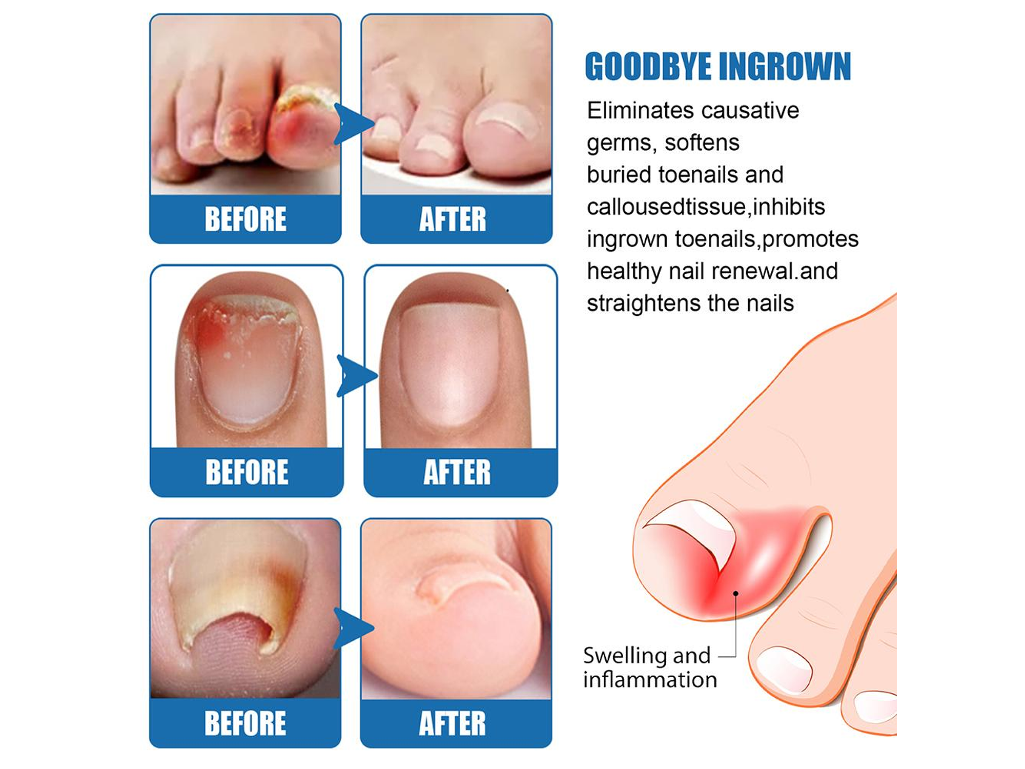 Lápiz Reparador Biológico South Moon con Extractos Naturales – Uso Tópico 3ml 2