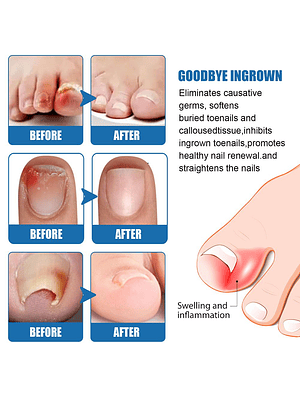 Lápiz Reparador Biológico South Moon con Extractos Naturales – Uso Tópico 3ml