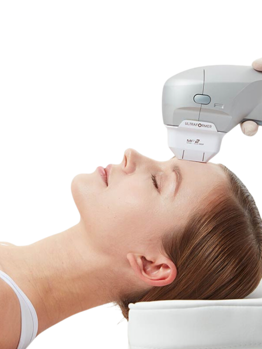 Lifting Facial con Ultraformer III (HIFU) 1