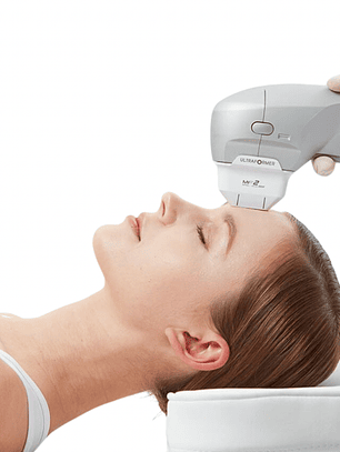 Lifting Facial con Ultraformer III (HIFU)