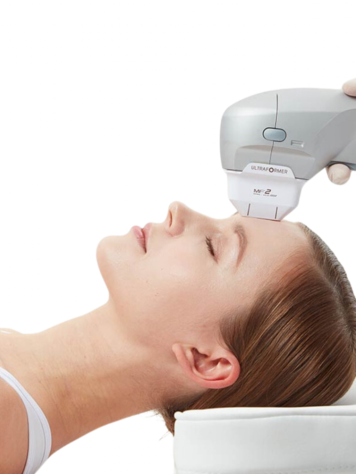 Lifting Facial con Ultraformer III (HIFU) 1