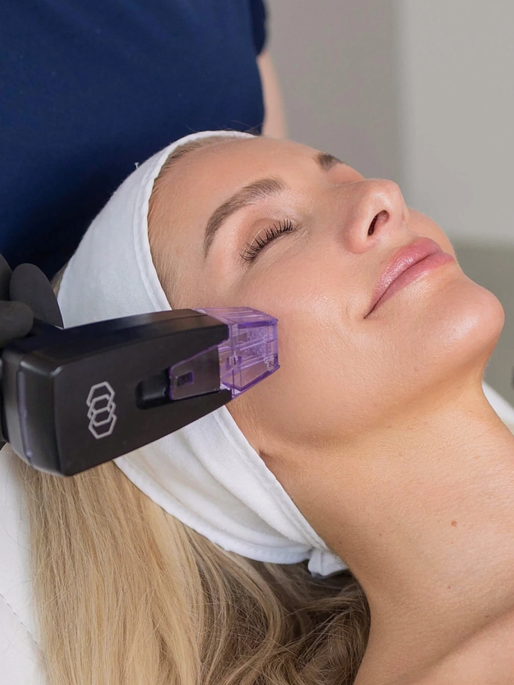 Rejuvenecimiento Facial Integral Morpheus8 + DMAE 1