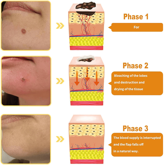 Crema correctora de veneno de abeja, Crema correctora de ven