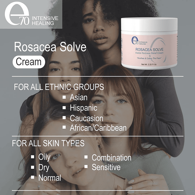 Rosacea Solve - Crema para aliviar el enrojecimiento - Hidra