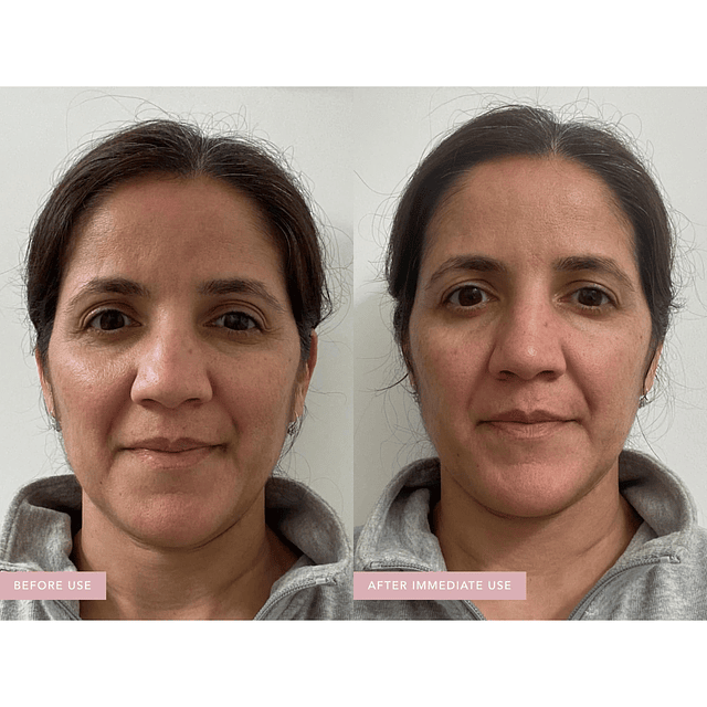 RANAVAT Crema facial renovadora Bakuchi - Hidratante facial