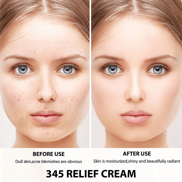 2 cremas de alivio 345, crema reparadora 345, crema hidratan