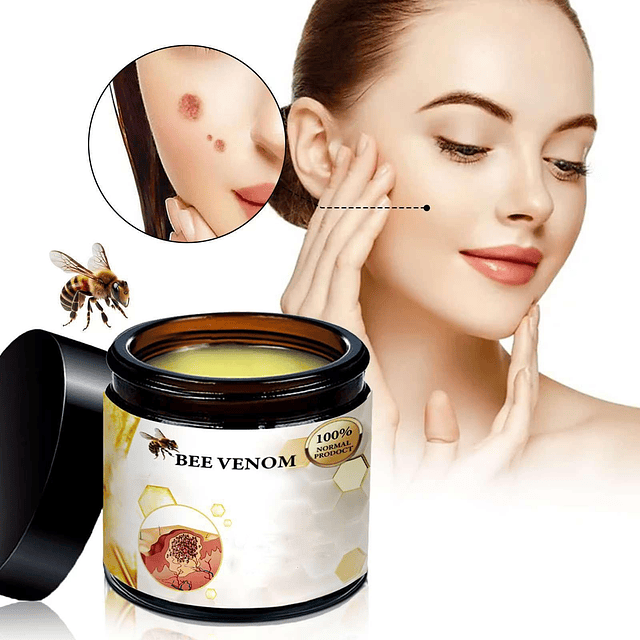 Crema para el tratamiento de la piel con veneno de abeja, el