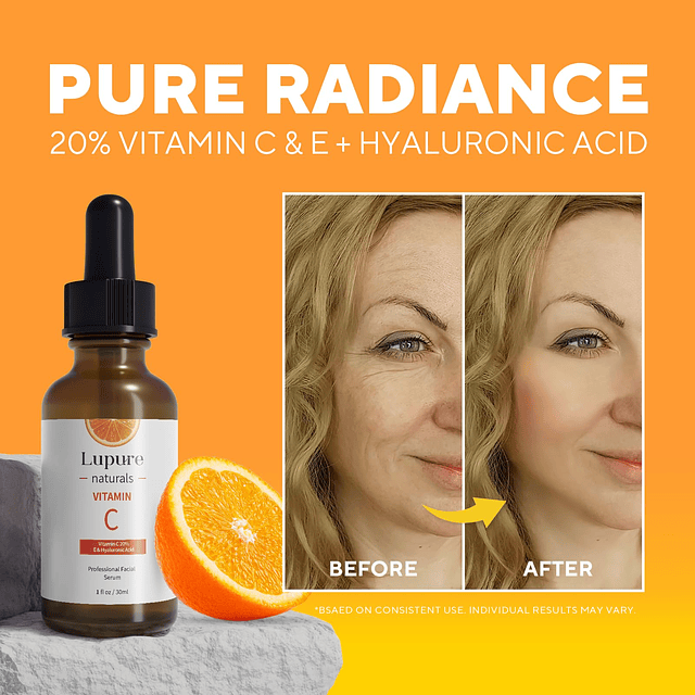 Professional Vitamin C Face Serum 20%, suero facial antienve