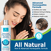 Shampoo para psoriasis, Shampoo para dermatitis seborreica,