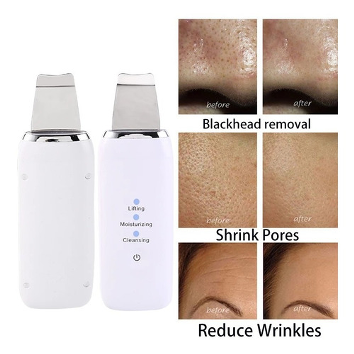 Limpiador Depurador Facial Ultrasónico Paleta/waoscl 9