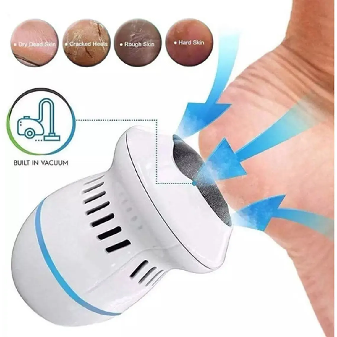 Exfoliador Removedor De Callos Pies Limpieza Pedicure   9