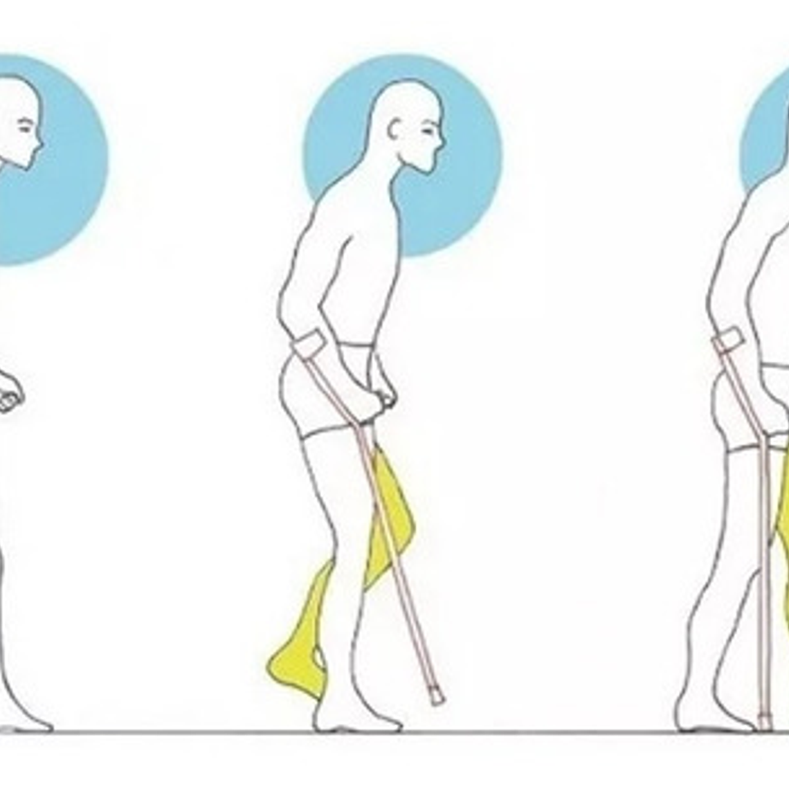 2 Bastón Muleta Canadiense Regulable En Altura Color Plateado 3