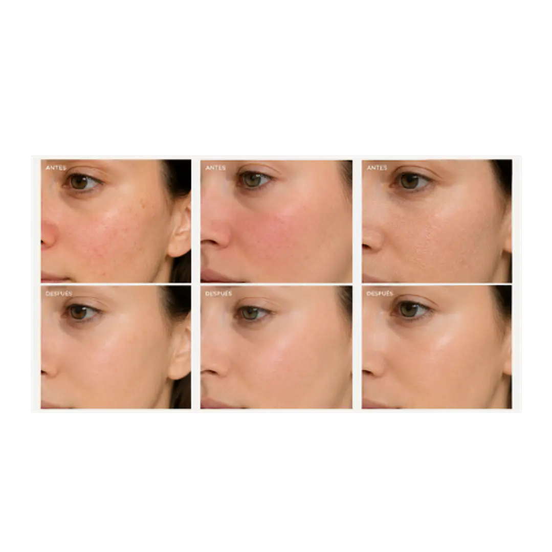 OAT REPAIR SERUM 2