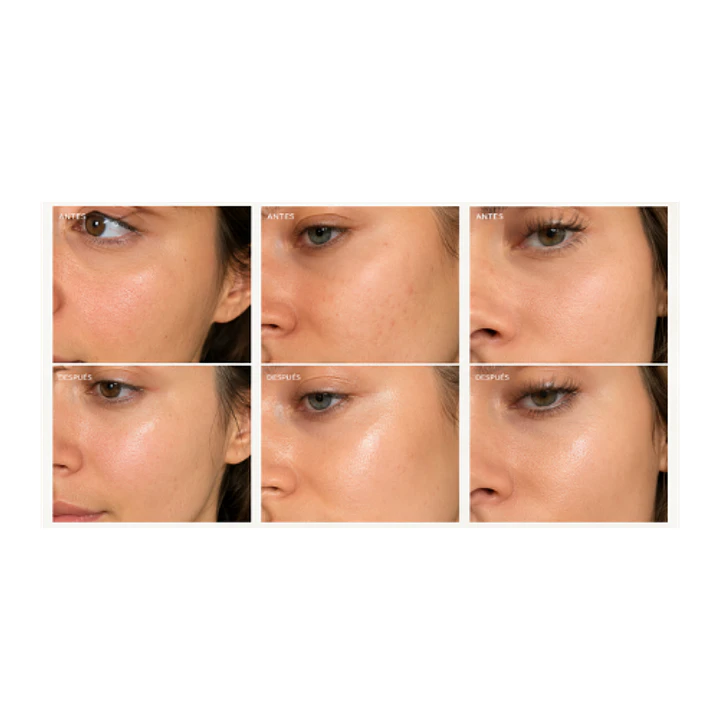 HYALURONIC ACID SERUM 2
