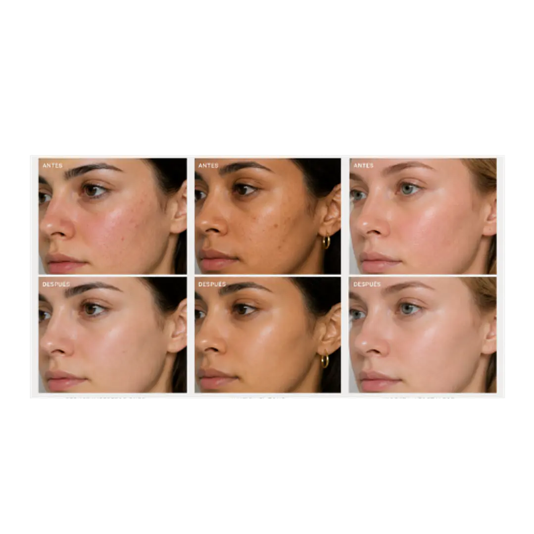 NIACINAMIDE SERUM 2