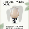 Rehabilitación Oral en Santiago: Cómo Recuperar tu Sonrisa y Confianza tras Perder un Diente