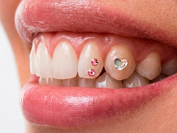 Instalación de Joyas en Dientes Chile | Gemas y Brillitos en Santiago | XBUCAL