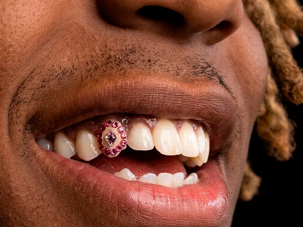 Gemas Dentales para Hombres en Santiago de Chile: Lleva tu Sonrisa al Estilo de la Música Urbana