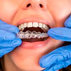 Plano de Relajación en Santiago: La Solución Clínica al Bruxismo, Dolores de Cabeza y Desgaste Dental