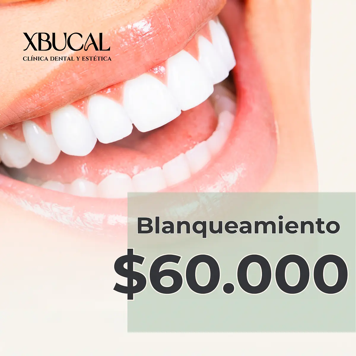Xbucal