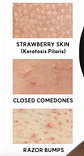 Arencia - Sérum Eraser Shot Glycolic Acid Booster - Miniatura 3