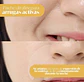 MADFORCOS - Wrinkle Master Patch : Smile Line (36 parches)  - Miniatura 3