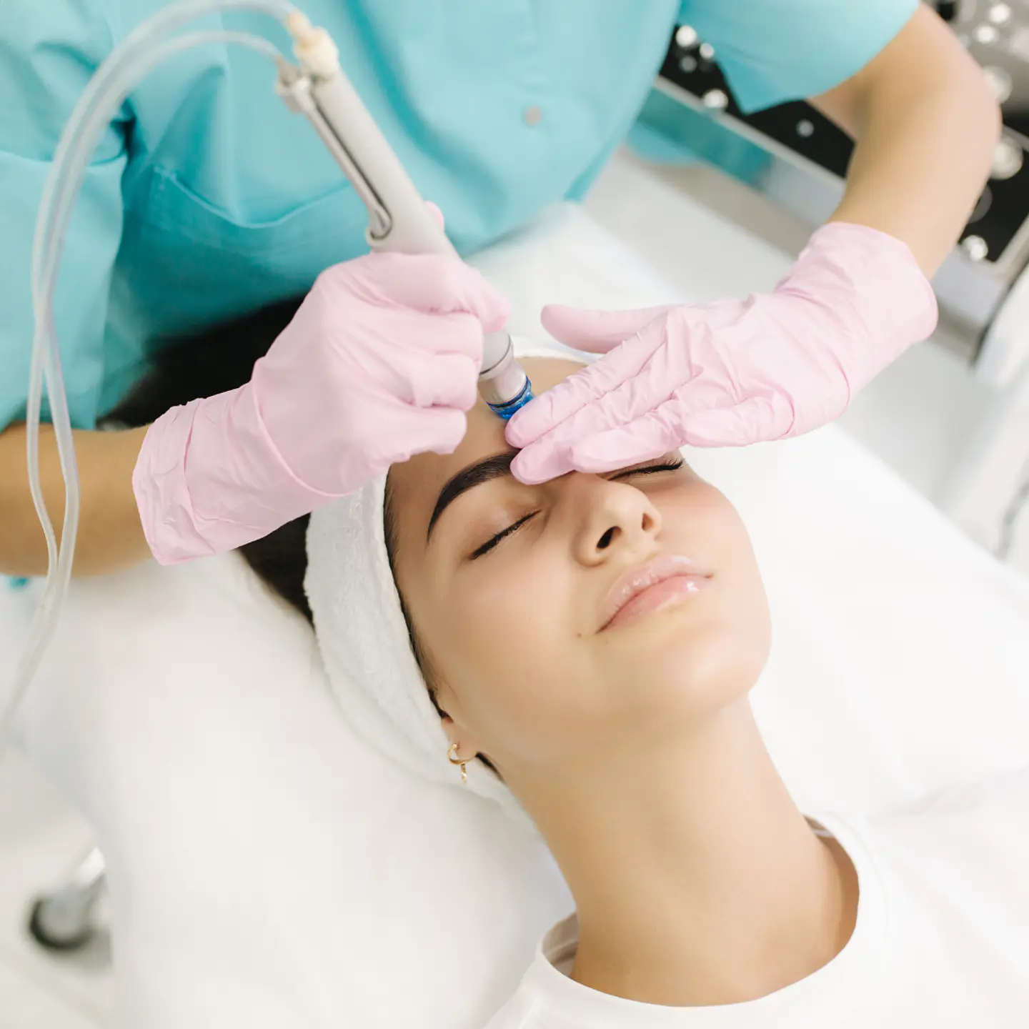Limpieza Facial Profunda con Microdermoabrasión 1